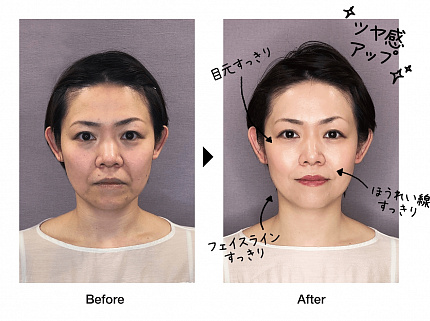 Антивозрастной тональный лифтинг кушон с защитой от солнца Dr.Soie Amaranth 5G Lift Foundation SPF40+ / PA +++, цвет Natural, 12 г